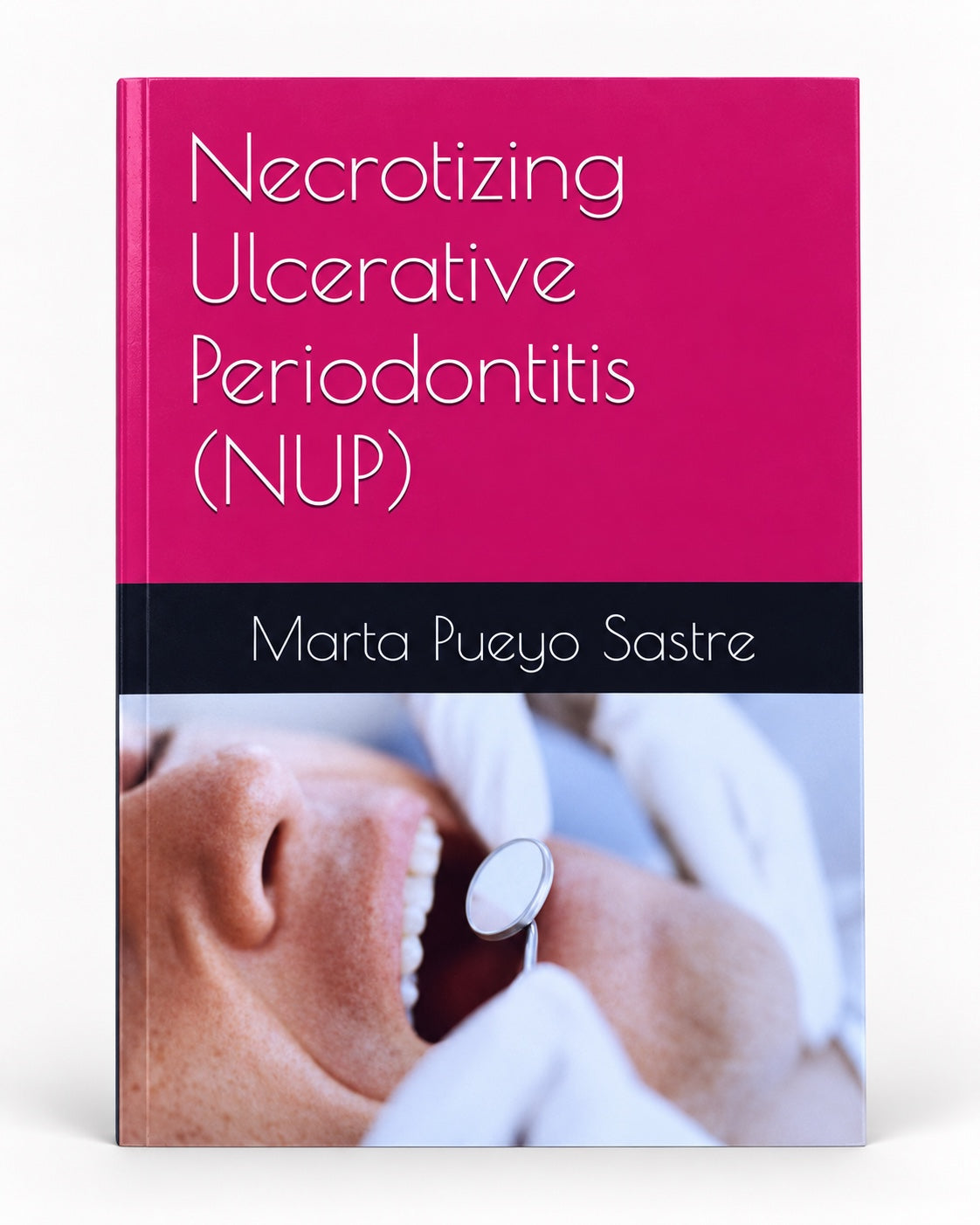 Portada de Necrotizing Ulcerative Periodontitis (NUP), edición limitada, de Marta Pueyo Sastre