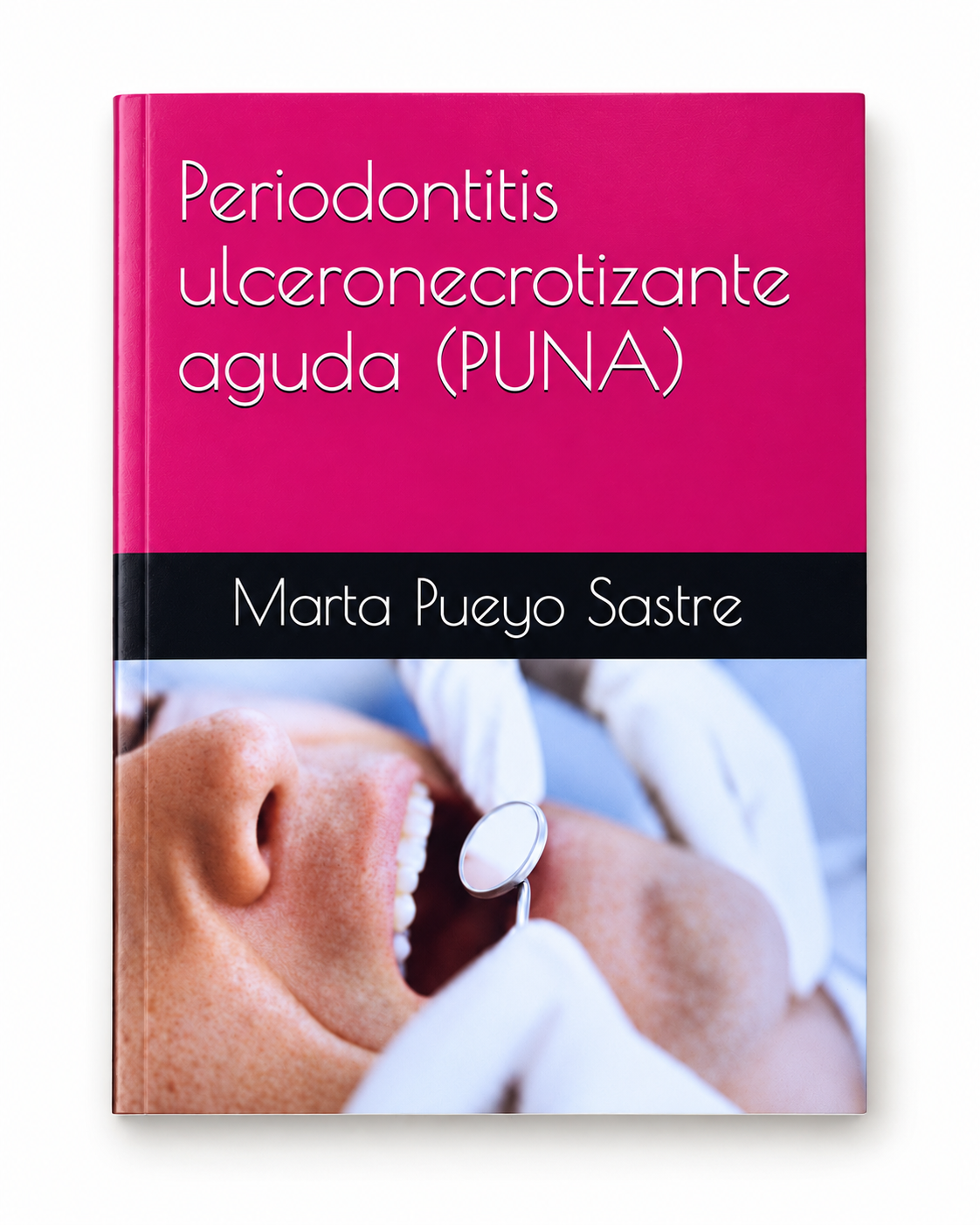 Portada de Periodontitis ulceronecrotizante aguda (PUNA), edición limitada anterior, de Marta Pueyo Sastre